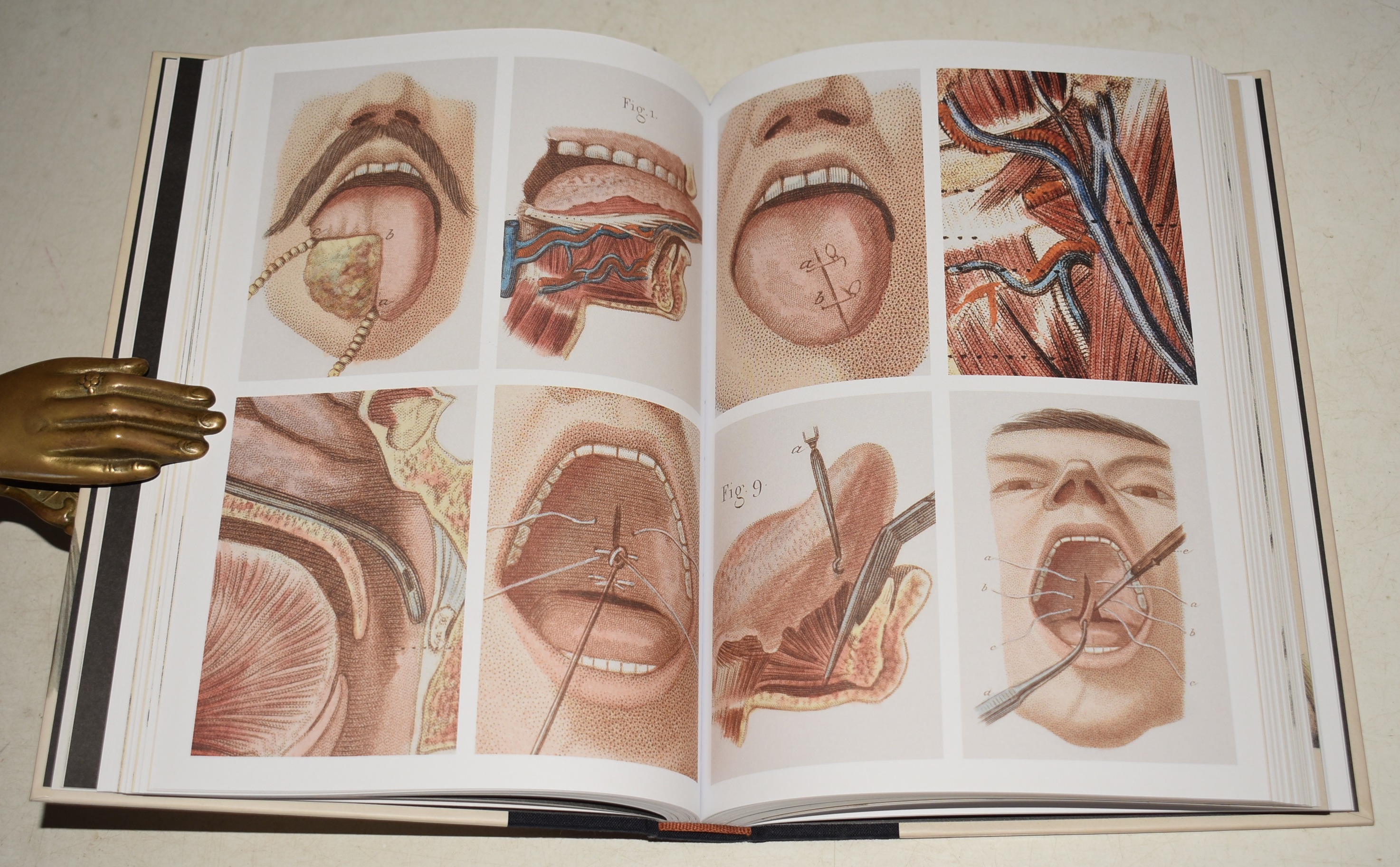 Crucial Interventions An Illustrated Treatise on the Principles & Practice of Nineteenth-Century Surgery